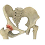 Osteoarthritis of the Hip 